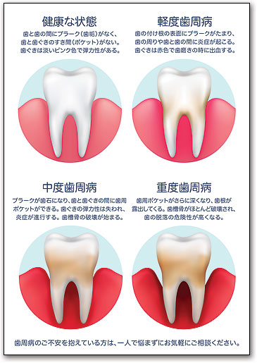 リコールカード　スタンダード　Ｒ７３８ by SmartPractice