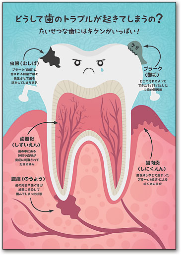 リコールカード　スタンダード　Ｒ７３9 by SmartPractice