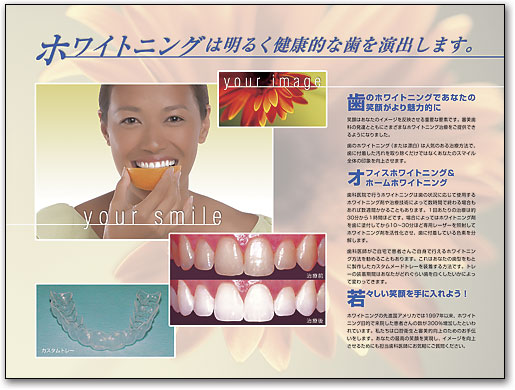 ポスターアート　ホワイトニング by SmartPractice