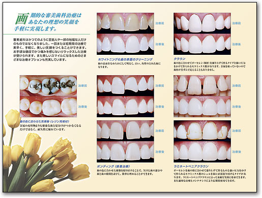 ポスターアート　画期的な審美歯科治療 by SmartPractice