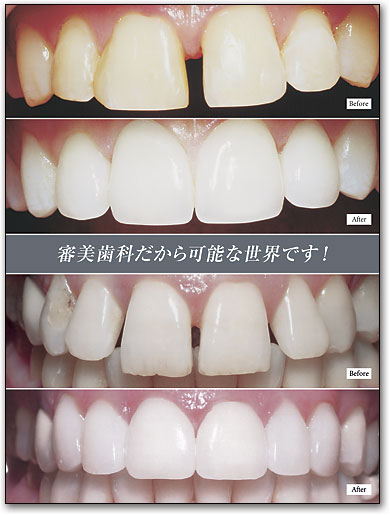 ポスターアート　Before＆After＃9 by SmartPractice