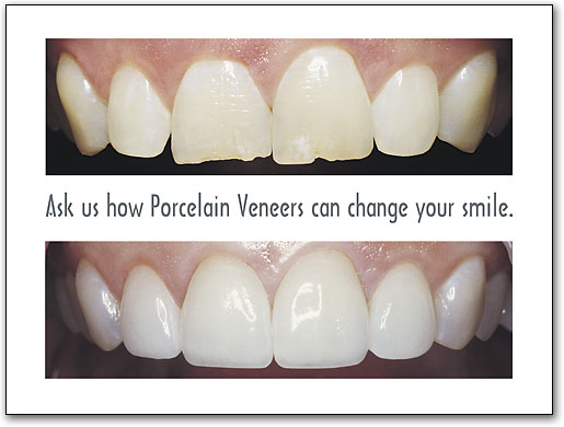 ポスターアート　Before＆After＃5 by SmartPractice