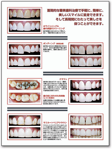 ポスターアート　Before＆After＃3 by SmartPractice